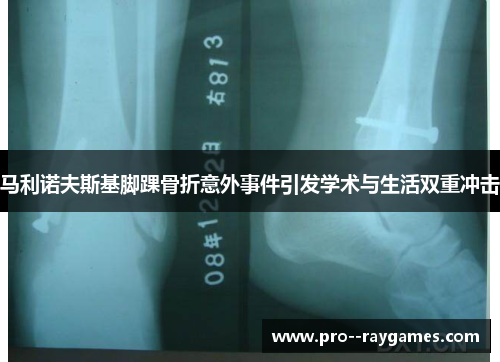 马利诺夫斯基脚踝骨折意外事件引发学术与生活双重冲击